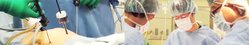 腹腔鏡手術のメリット画像