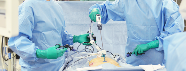 腹腔鏡手術はどんな手術？イメージ画像